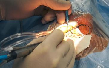 Concluyen con éxito 37 operaciones visuales para mejorar la calidad de vida de sonorenses